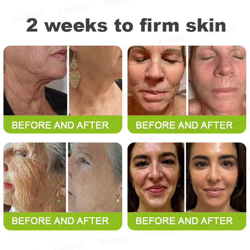 💍🟢Rolimey® Vita-A Retinol Shot Wrinkle-Lift Tightening cream