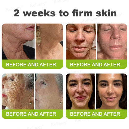 💍🟢Rolimey® Vita-A Retinol Shot Wrinkle-Lift Tightening cream
