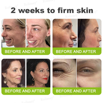 💍🟢Rolimey® Vita-A Retinol Shot Wrinkle-Lift Tightening cream