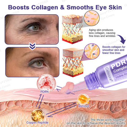 🫧🍀Celsiora® PDRN Renewal Complex Eye Cream | Wrinkles, Puffiness & Dark Circles