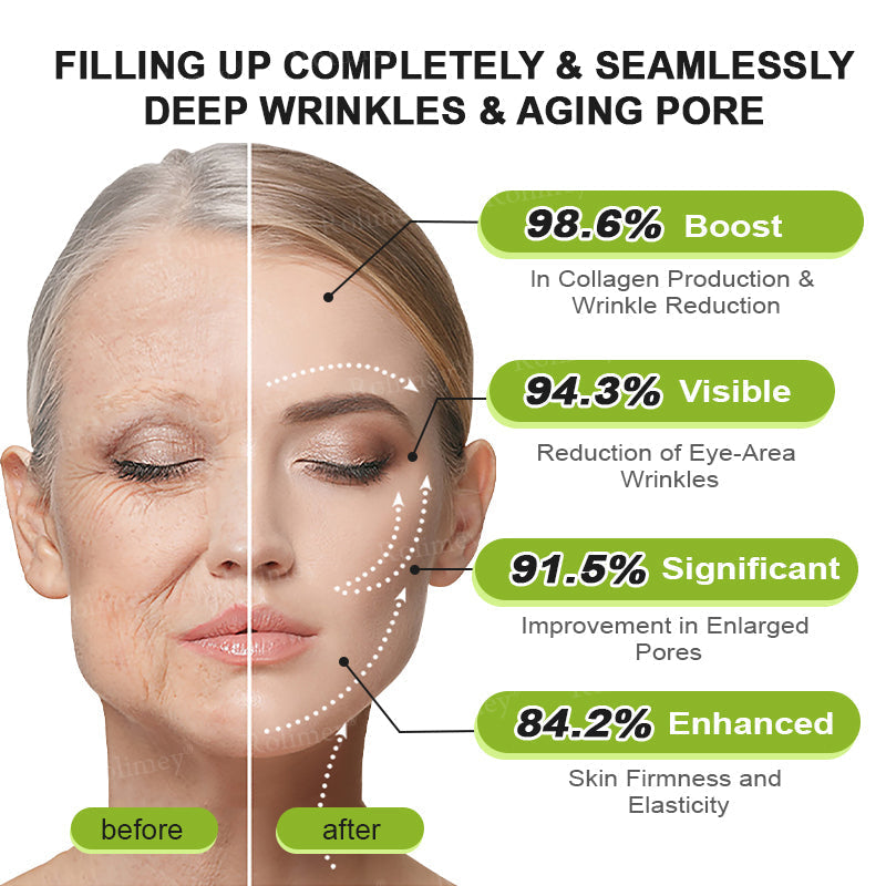💍🟢Rolimey® Vita-A Retinol Shot Wrinkle-Lift Tightening cream