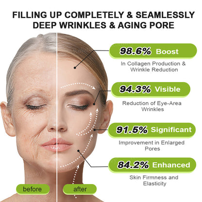 💍🟢Rolimey® Vita-A Retinol Shot Wrinkle-Lift Tightening cream