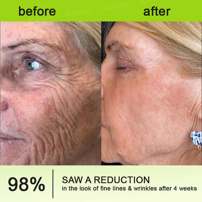 💍🟢Rolimey® Vita-A Retinol Shot Wrinkle-Lift Tightening cream