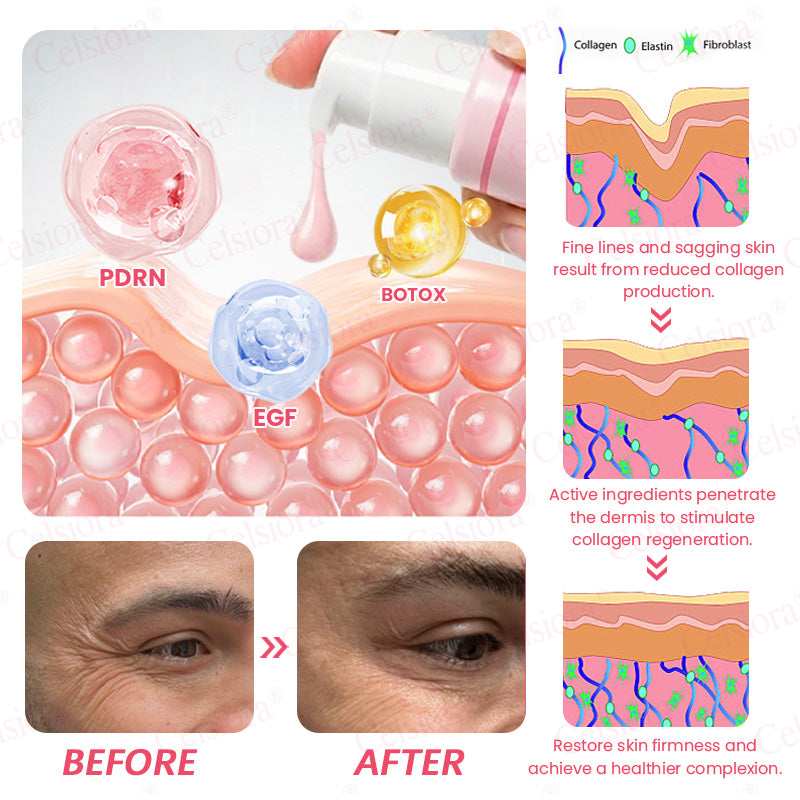 🩷✅Celsiora® PDRN Pink Peptide Eye Cream