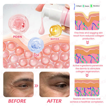 🩷✅Celsiora® PDRN Pink Peptide Eye Cream