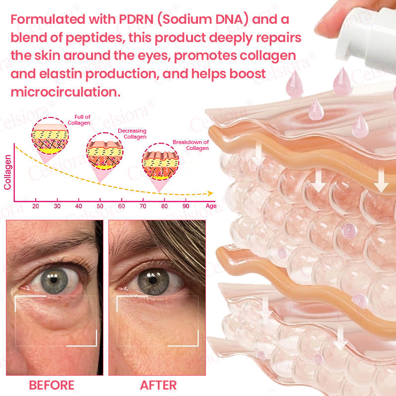 💝Celsiora® PDRN Pink Peptide Eye Cream
