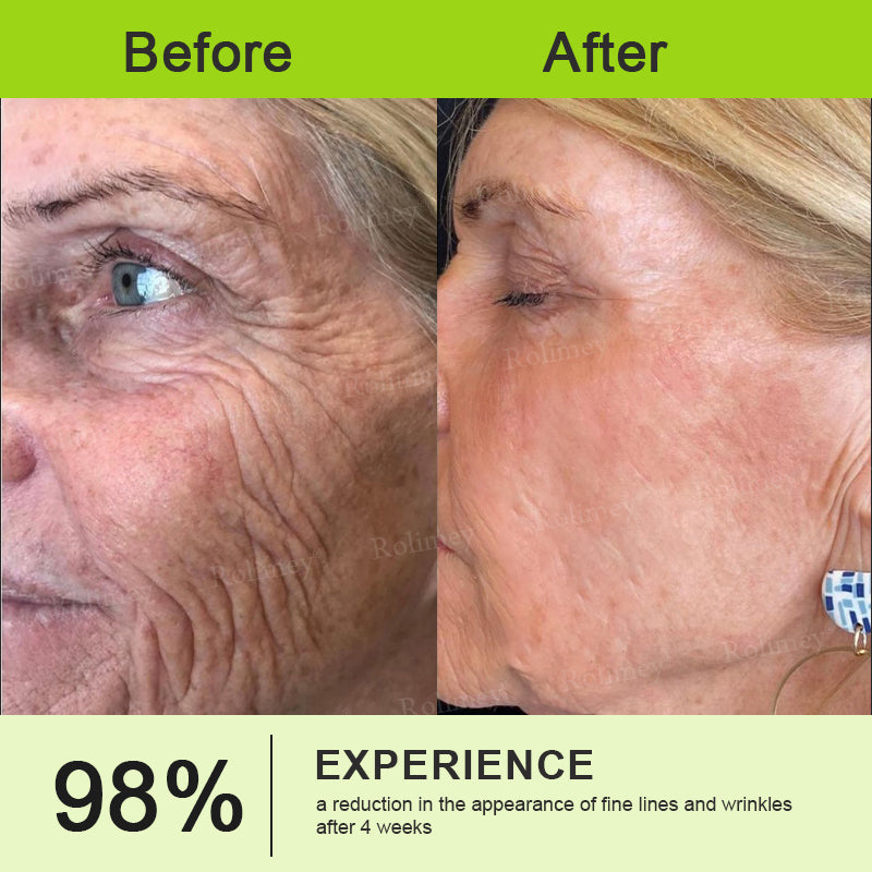 👨‍⚕️Rolimey® Botox & Vita-A Retinol Shot Wrinkle-Lift Tightening stick