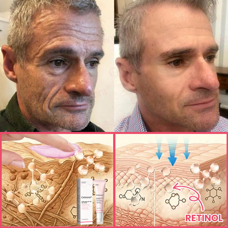 💗💚Celsiora® PDRN Pink Peptide Eye Cream