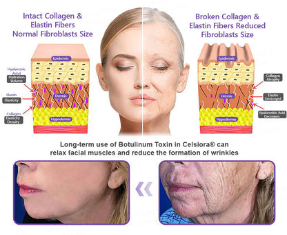 FDA Official: Celsiora® PDRN Multi-Peptide Massaging Body Roller Cream- Anti-aging, Hydrating, Skin Firming & Lifting, Skin Repair, Even Tone, Acne and Dark Spot Treatment, Wart and Mole Removal, and Psoriasis Relief.