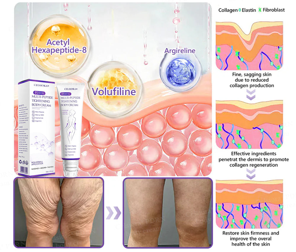 FDA Official: Celsiora® PDRN Multi-Peptide Massaging Body Roller Cream- Anti-aging, Hydrating, Skin Firming & Lifting, Skin Repair, Even Tone, Acne and Dark Spot Treatment, Wart and Mole Removal, and Psoriasis Relief.