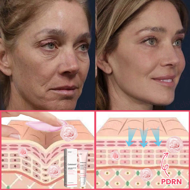 💗💚Celsiora® PDRN Pink Peptide Eye Cream