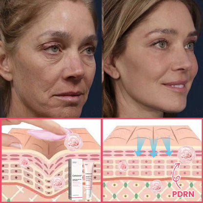 💗💚Celsiora® PDRN Pink Peptide Eye Cream