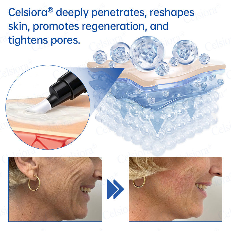 🥈📌💨UK HOT SALE Celsiora® PDRN Anti-Wrinkle Shot – Lift & Firming Cream