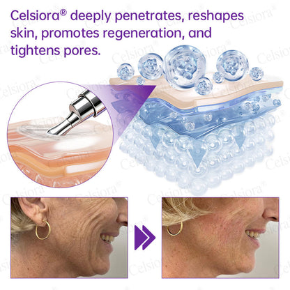 🥈🥈💫Celsiora® Botox & PDRN Anti-Wrinkle Shot – Lift & Firming Cream