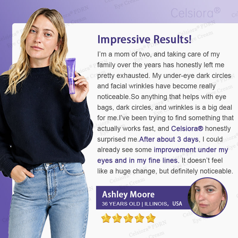 💎✨Celsiora® PDRN Renewal Complex Eye Cream | Wrinkles, Puffiness & Dark Circles
