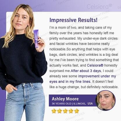 💎✨Celsiora® PDRN Renewal Complex Eye Cream | Wrinkles, Puffiness & Dark Circles