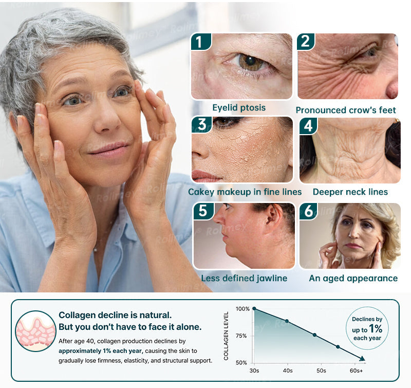 💚✅Rolimey® Botox & Stem Cell Wrinkle-Lift Tightening Cream