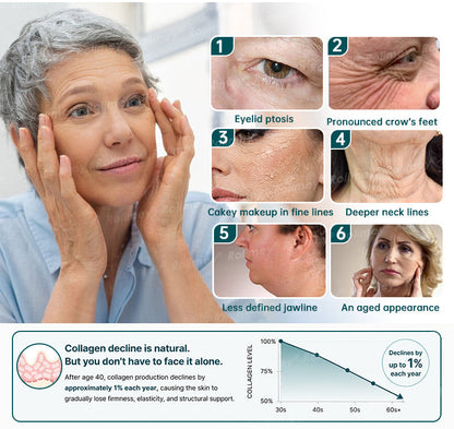 💚✅Rolimey® Botox & Stem Cell Wrinkle-Lift Tightening Cream