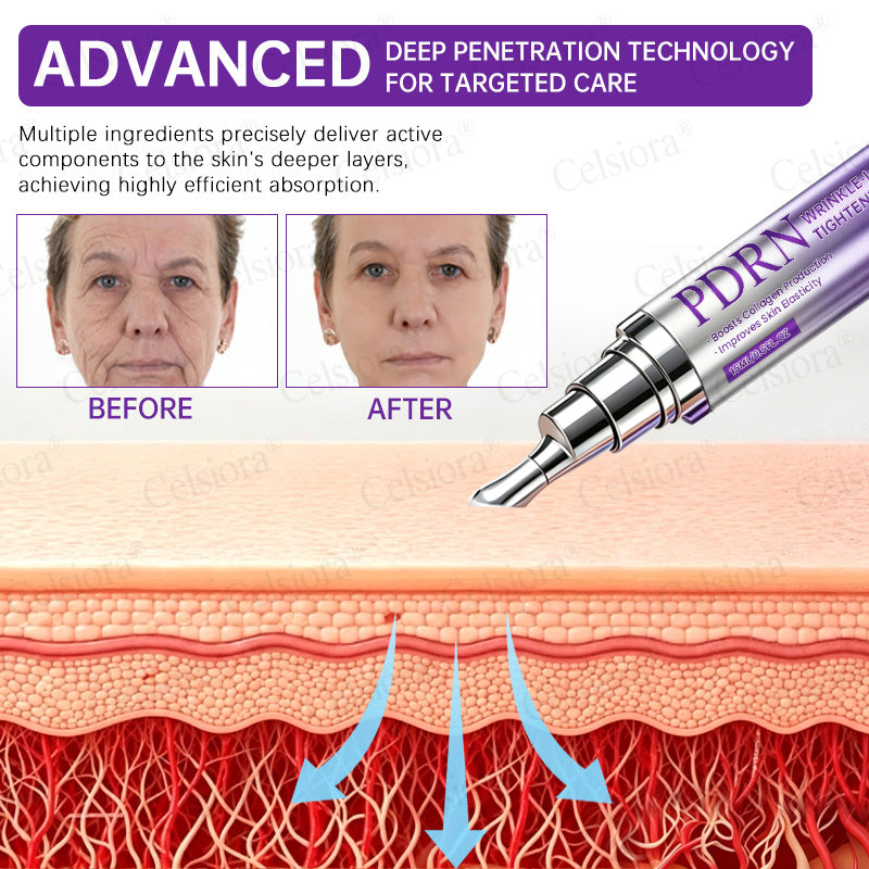 🥈🥈💫Celsiora® Botox & PDRN Anti-Wrinkle Shot – Lift & Firming Cream