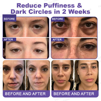 ✨Celsiora® PDRN Renewal Complex Eye Cream (upsell)