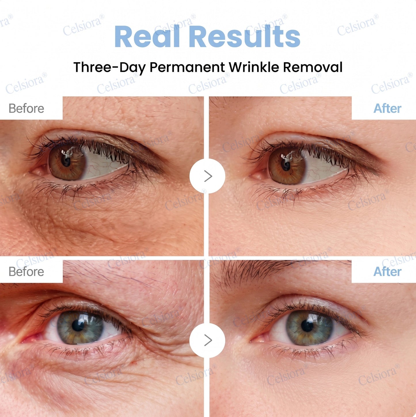 🥈🎁UK HOT SALE Celsiora® PDRN Anti-Wrinkle Shot – Lift & Firming Cream
