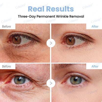 💫Celsiora® Botox & PDRN Anti-Wrinkle Shot – Lift & Firming Cream