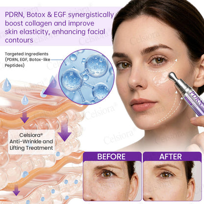 🥈🥈💫Celsiora® Botox & PDRN Anti-Wrinkle Shot – Lift & Firming Cream