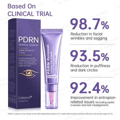 🥽✨Celsiora® PDRN Renewal Complex Eye Cream | Wrinkles, Puffiness & Dark Circles