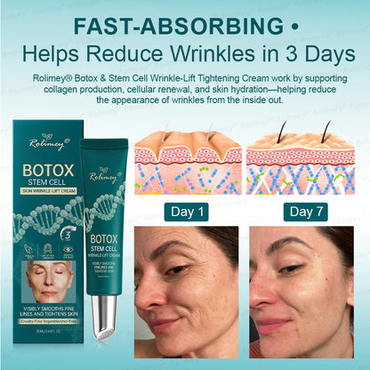 💚✅Rolimey® Botox & Stem Cell Wrinkle-Lift Tightening Cream