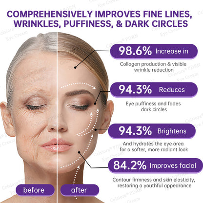 💎🌟💄Celsiora® PDRN Renewal Complex Eye Cream | Wrinkles, Puffiness & Dark Circles