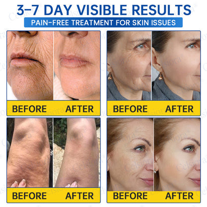 🥈💛💛UK HOT SALE Celsiora® PDRN Anti-Wrinkle Shot – Lift & Firming Cream