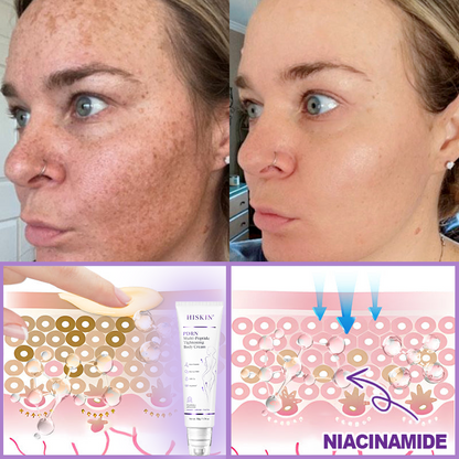 FDA Official: Celsiora® PDRN Multi-Peptide Massaging Body Roller Cream- Anti-aging, Hydrating, Skin Firming & Lifting, Skin Repair, Even Tone, Acne and Dark Spot Treatment, Wart and Mole Removal, and Psoriasis Relief.