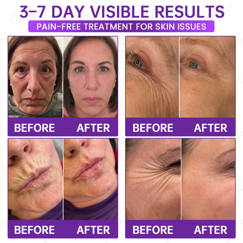 🥈🥈💫Celsiora® Botox & PDRN Anti-Wrinkle Shot – Lift & Firming Cream