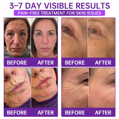 🥈🥈💫Celsiora® Botox & PDRN Anti-Wrinkle Shot – Lift & Firming Cream
