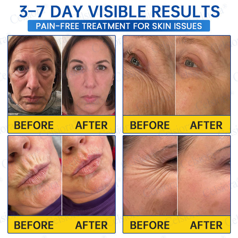 🥈✨UK HOT SALE Celsiora® PDRN Anti-Wrinkle Shot – Lift & Firming Cream