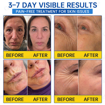 🥈✨UK HOT SALE Celsiora® PDRN Anti-Wrinkle Shot – Lift & Firming Cream