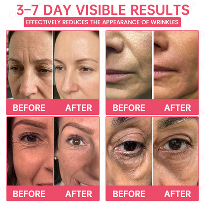 💗💚Celsiora® PDRN Pink Peptide Eye Cream