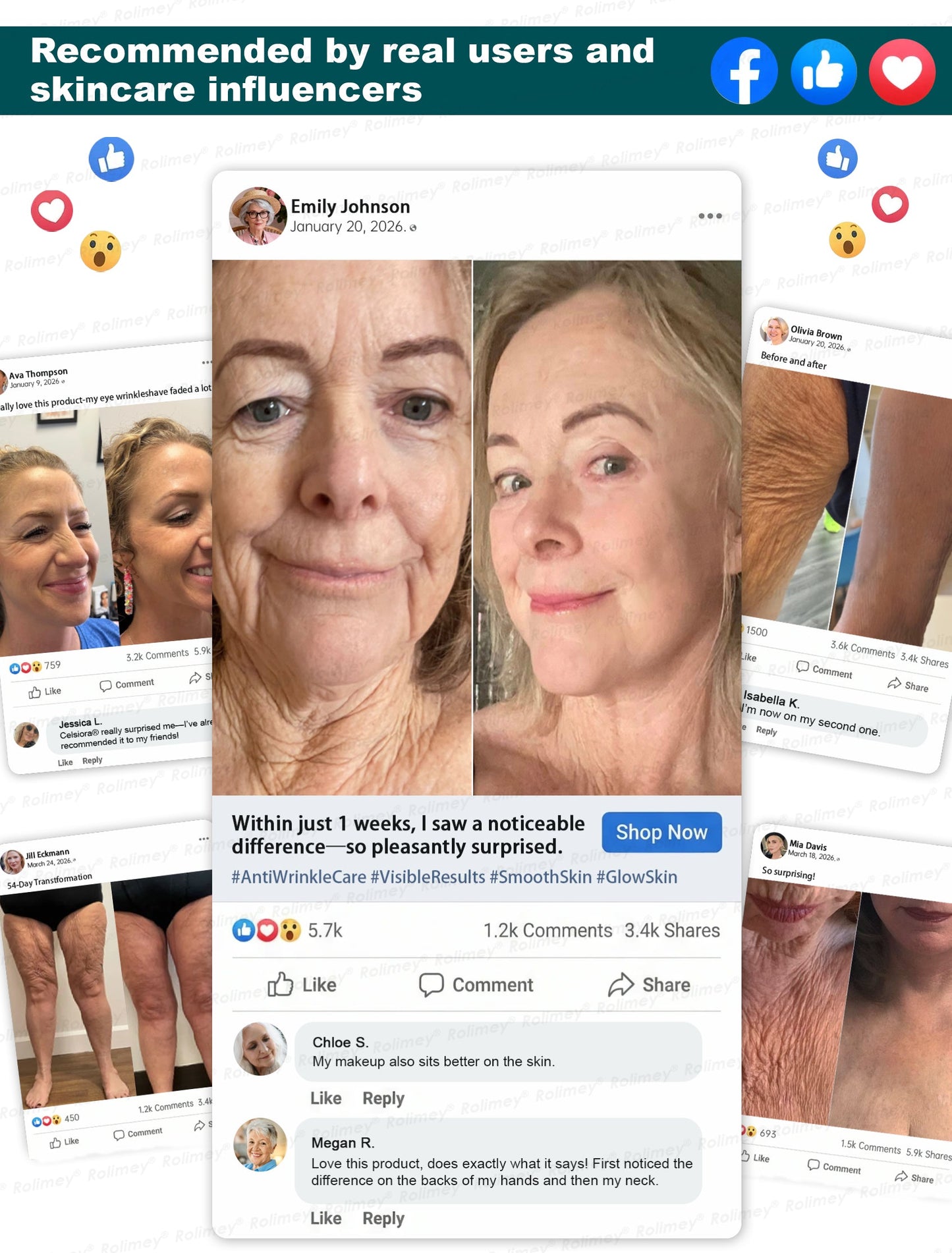 🎫♻👨‍⚕️Rolimey® Botox & Stem Cell Wrinkle-Lift Tightening Cream