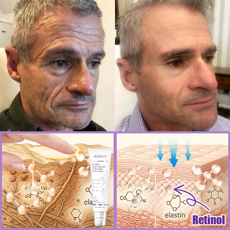 FDA Official: Celsiora® PDRN Multi-Peptide Massaging Body Roller Cream- Anti-aging, Hydrating, Skin Firming & Lifting, Skin Repair, Even Tone, Acne and Dark Spot Treatment, Wart and Mole Removal, and Psoriasis Relief.