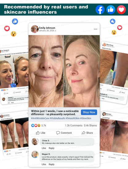 💚✅Rolimey® Botox & Stem Cell Wrinkle-Lift Tightening Cream