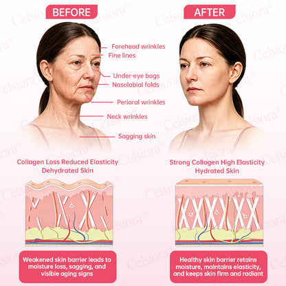 🩷✅Celsiora® PDRN Pink Peptide Eye Cream