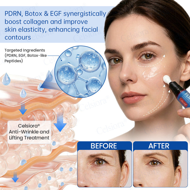 💫Celsiora® Botox & PDRN Anti-Wrinkle Shot – Lift & Firming Cream (UPSELL)