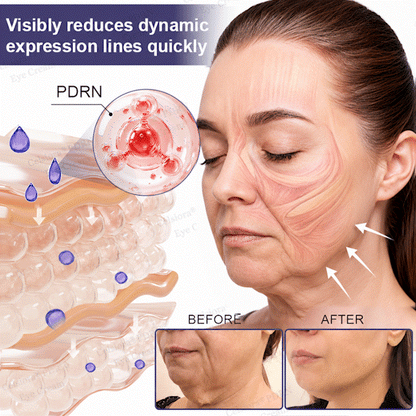 🥽✨Celsiora® PDRN Renewal Complex Eye Cream | Wrinkles, Puffiness & Dark Circles